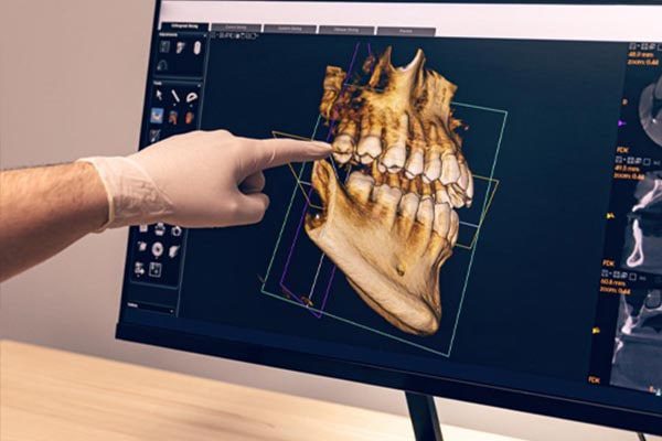 Advanced Dental Technology in Avondale, AZ