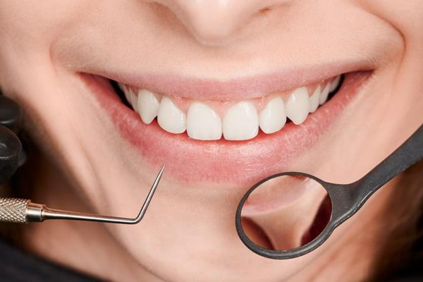 Cosmetic Dentistry in Avondale Arizona