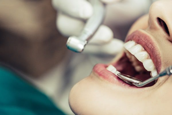 Extractions