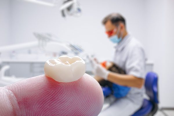 Porcelain Crowns