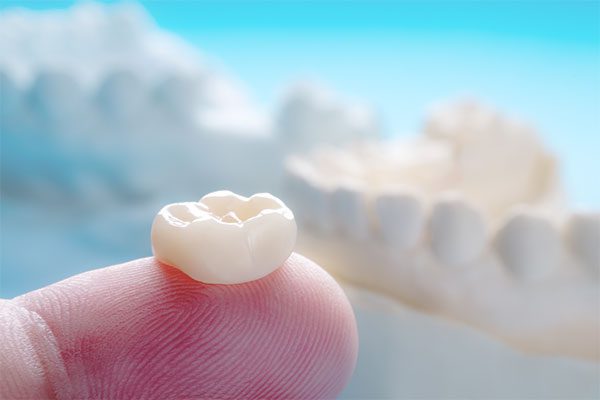 Porcelain Crowns