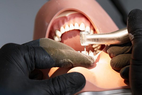 Dental Fillings in Avondale Arizona