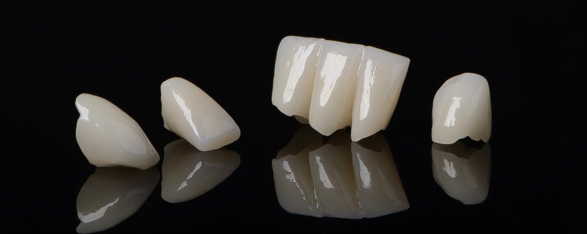 Temporary vs. Permanent Crown What is the Difference