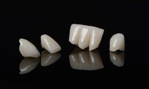 Temporary vs. Permanent Crown What is the Difference