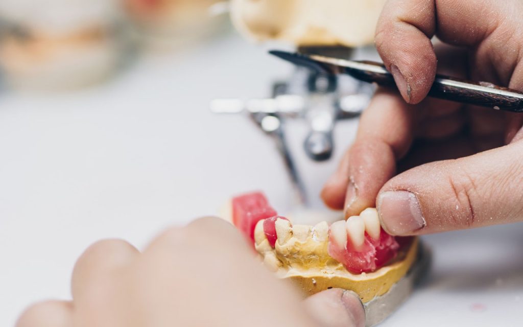 Dental Prosthetics in Avondale, Arizona