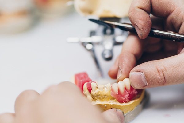 Dental Prosthetics Avondale