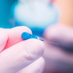 Root Canal and Crown Costs and Differences