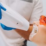 What are the Benefits of Teeth Whitening