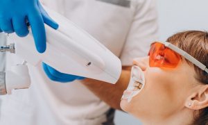 What are the Benefits of Teeth Whitening