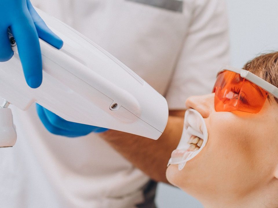 What are the Benefits of Teeth Whitening