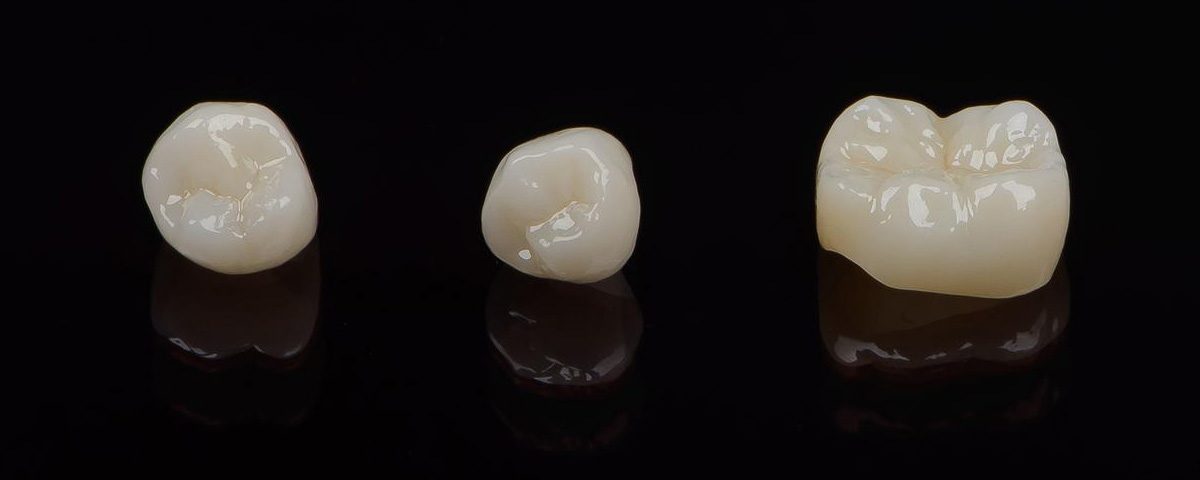 How Long do Porcelain Dental Crowns Last?