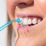 How Often Should You Have a Dental Cleaning