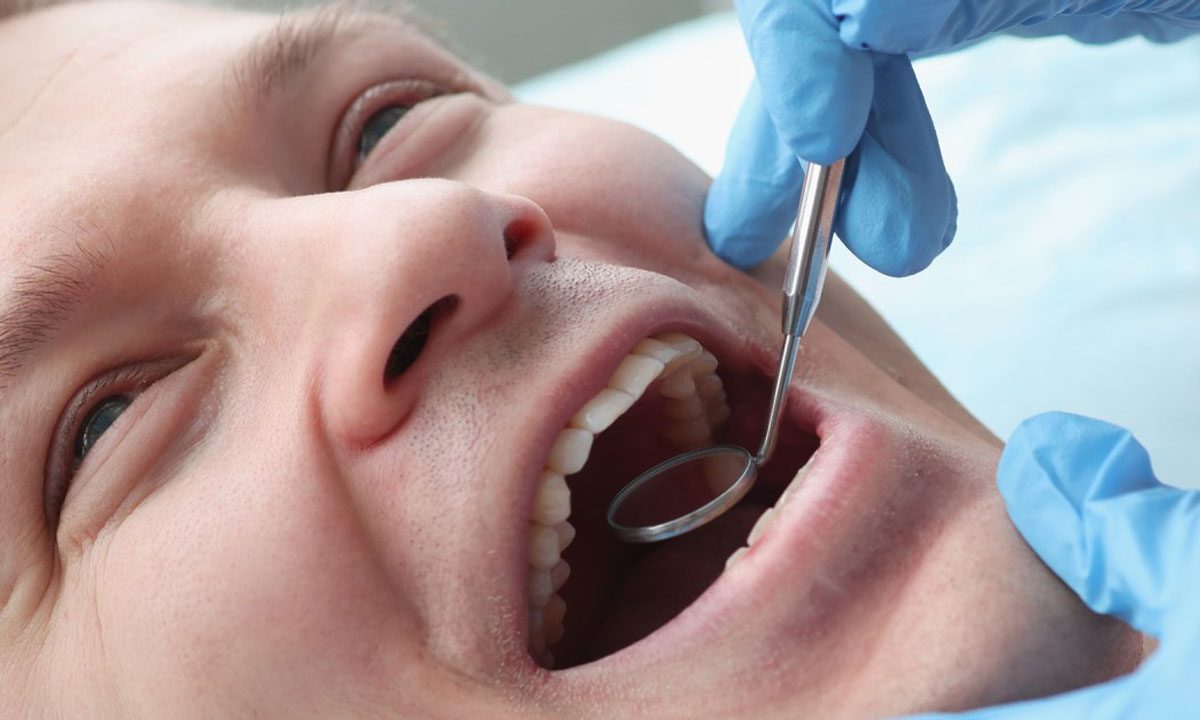 Is Tooth Cavity Filling Painful