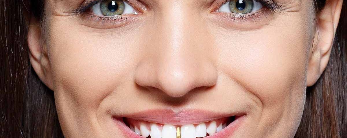 Tooth Caps Jewelry (Tooth Grillz)