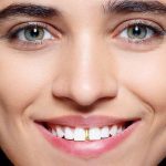 Tooth Caps Jewelry (Tooth Grillz)