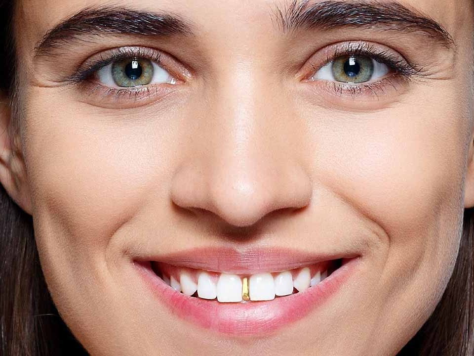 Tooth Caps Jewelry (Tooth Grillz)
