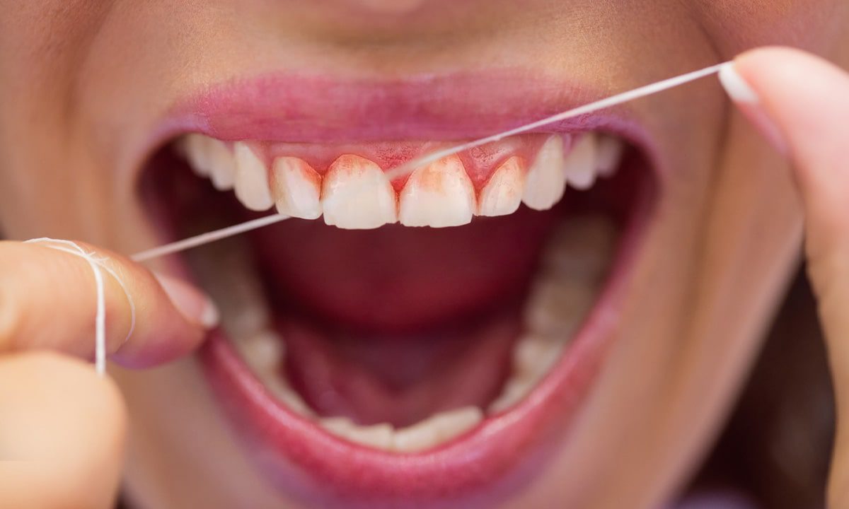 Why Do My Teeth Bleed When I Floss?