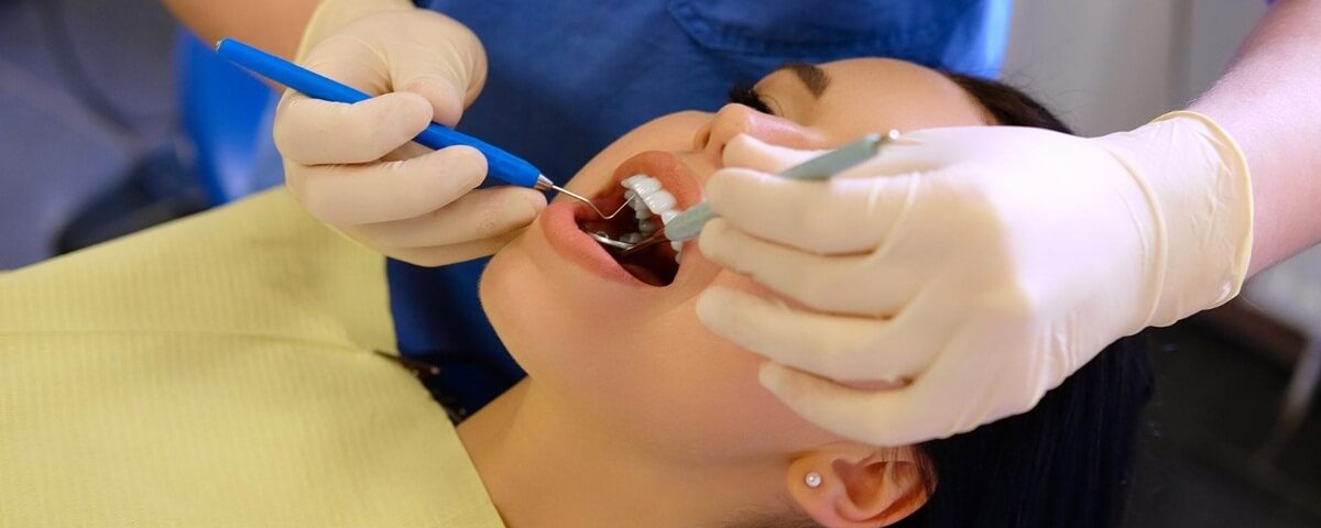 How Long Do Dental Fillings Last?