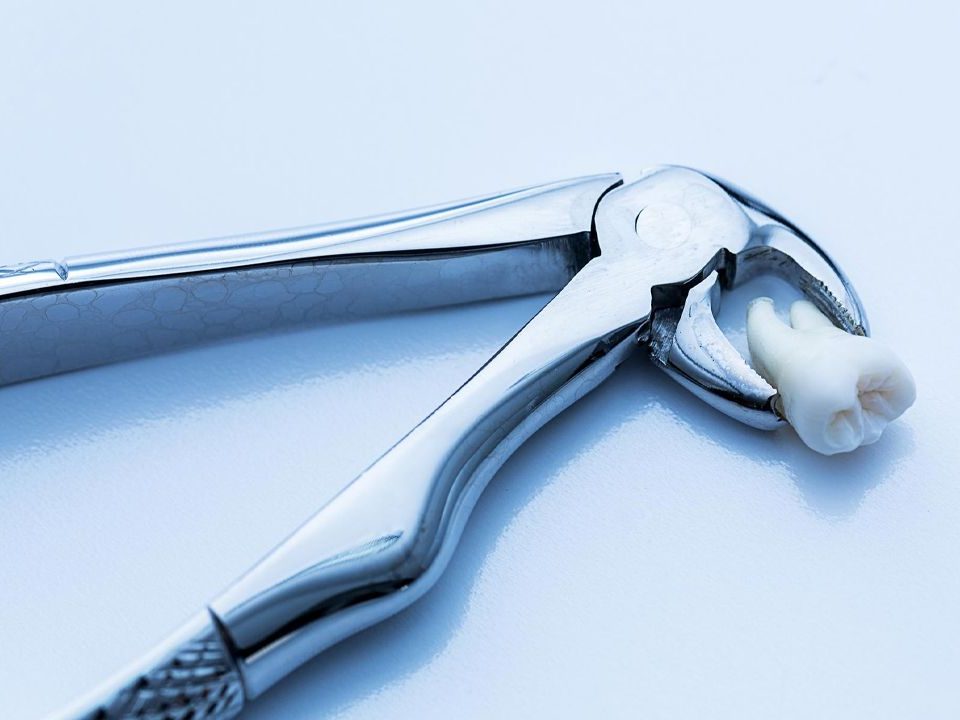 Will an ER Remove a Tooth?