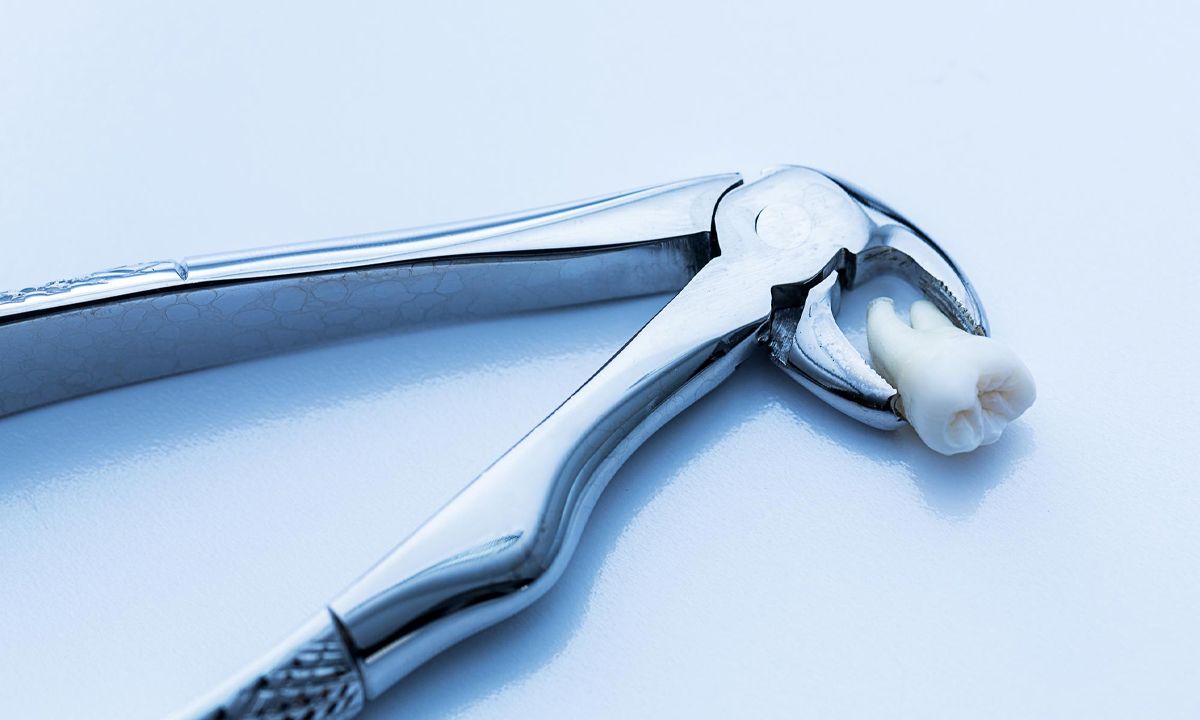 Will an ER Remove a Tooth?