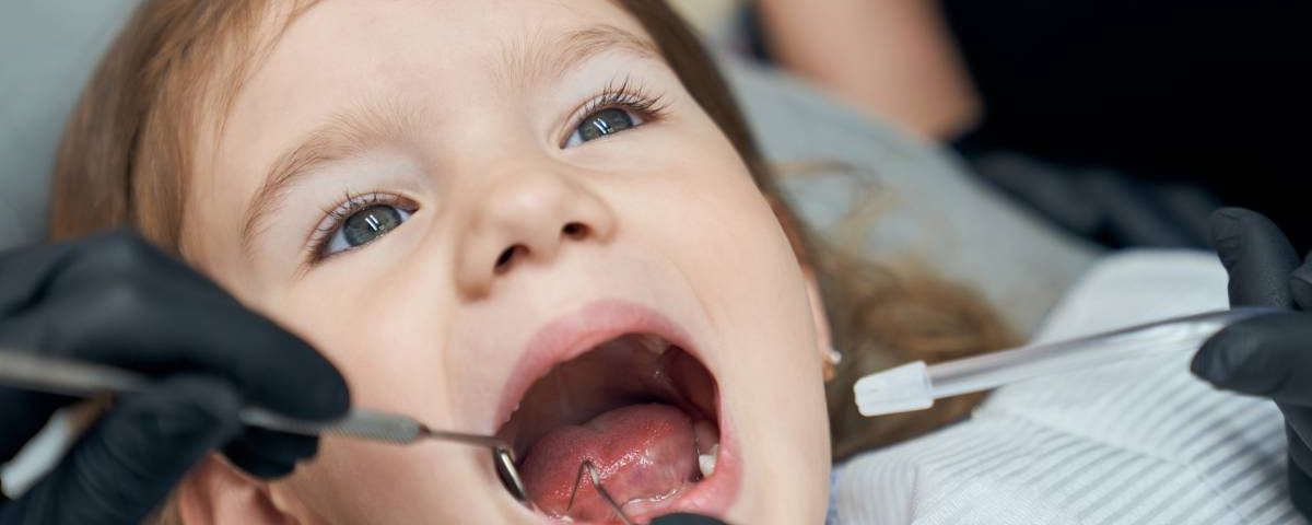 Should You Fill Cavities in Baby Teeth