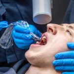 What Do Dentists Use to Fill Cavities?