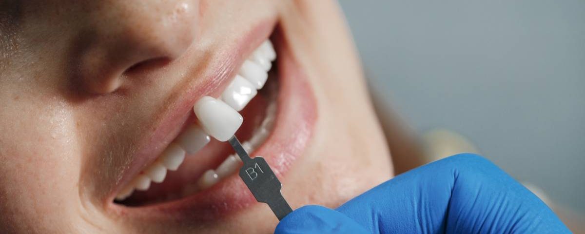 How Strong are Porcelain Crowns