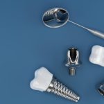 What Types of Dental Implants are Best