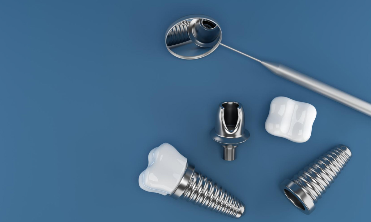 3 Types of Dental Implants Best Dental Implants