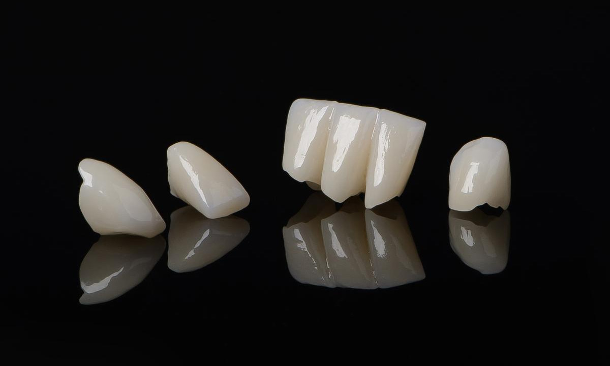 Temporary vs. Permanent Crown Which is Best?