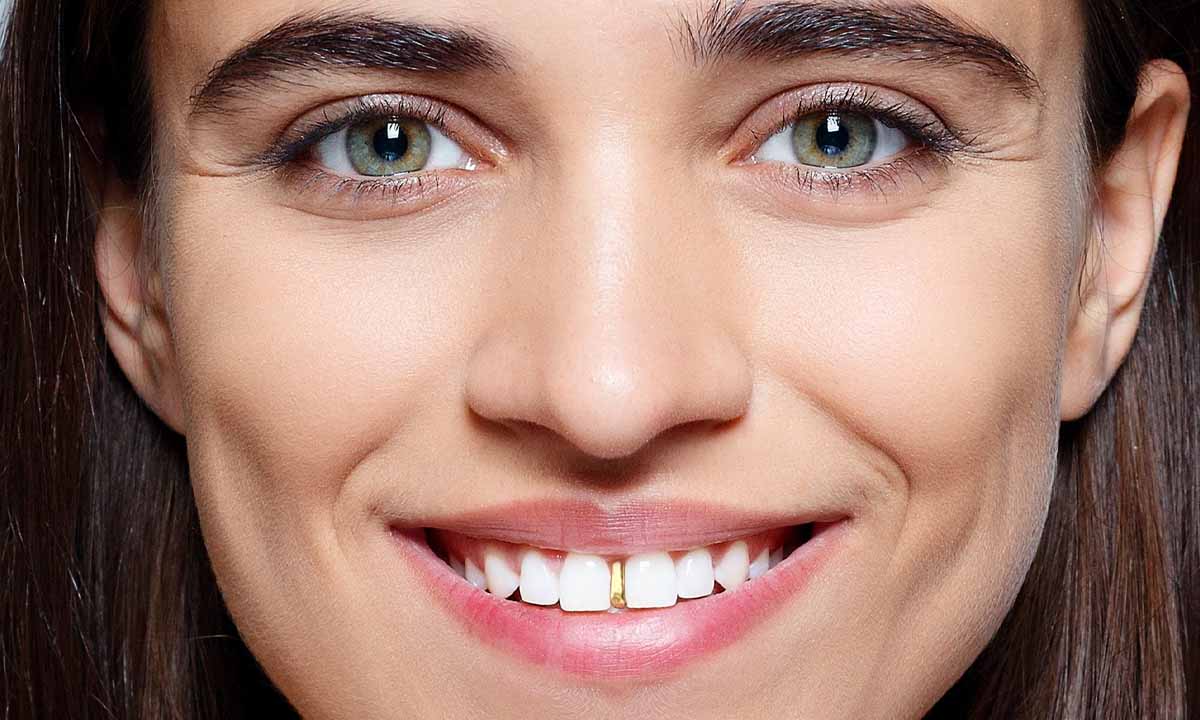 Tooth Caps Jewelry (Tooth Grillz)