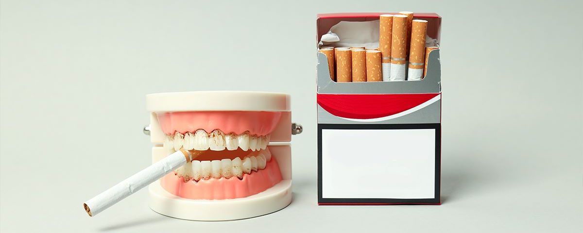 After Tooth Extraction, When Can You Smoke?