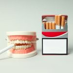 After Tooth Extraction, When Can You Smoke?