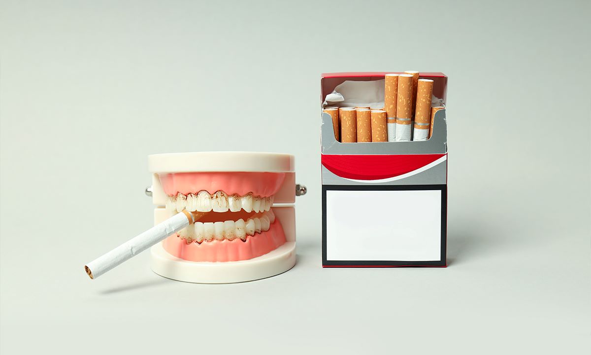 Can You Smoke After a Tooth Extraction? | Desert Lake Family Dentistry