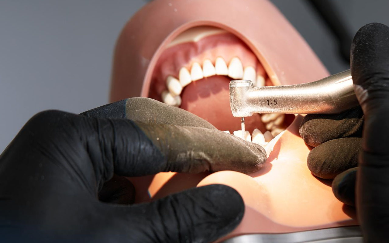 Dental Filling West Phoenix, AZ