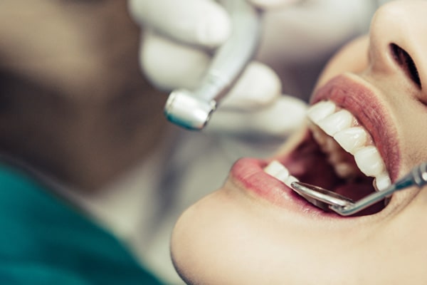 Extractions - Best Dentistry in Goodyear