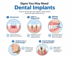 Signs You Need Dental Implants