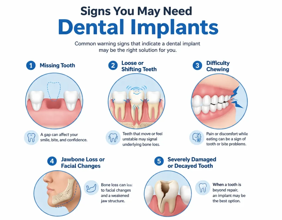 Signs You Need Dental Implants