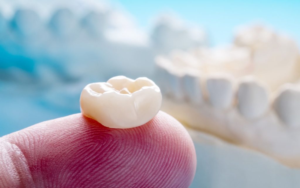 Porcelain Crowns Buckeye, AZ