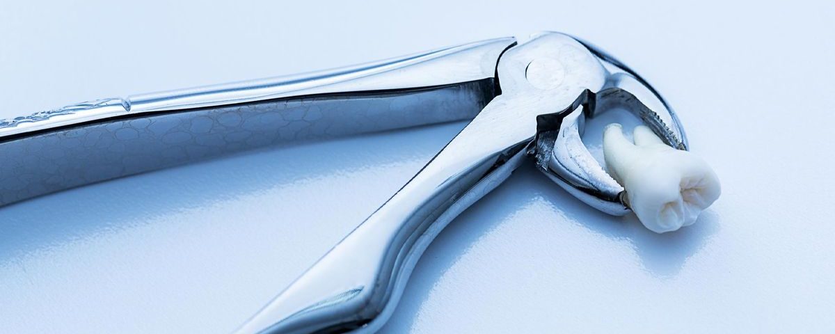 Will an ER Remove a Tooth?
