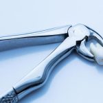 Will an ER Remove a Tooth?