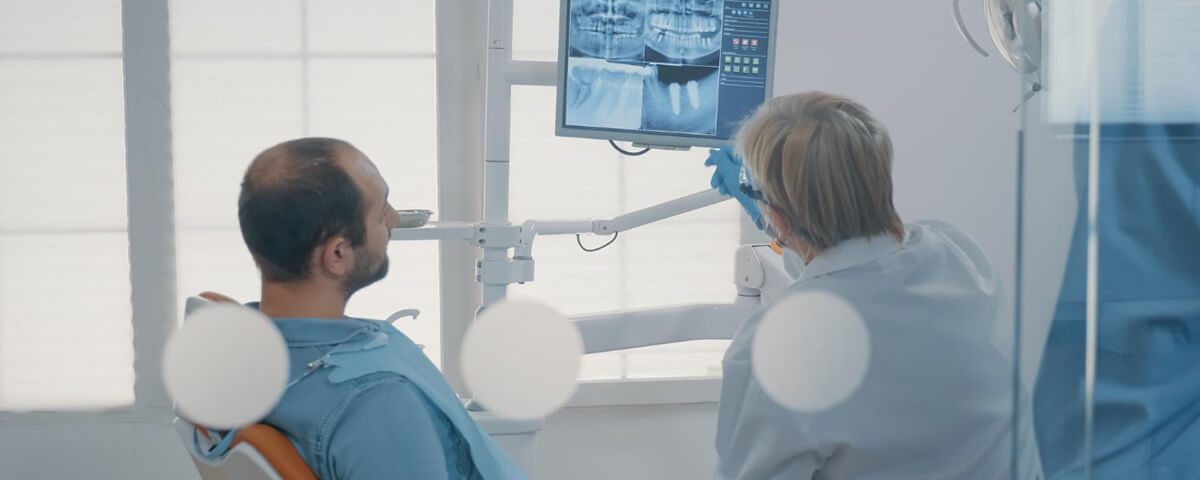 What You Should Know About Dental X-Ray Frequency