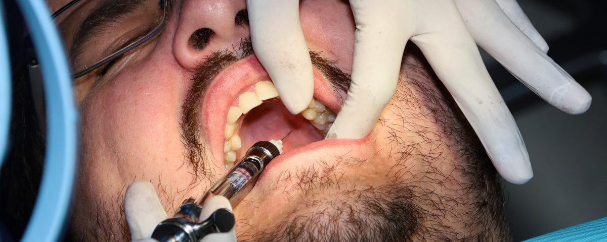 Broken Tooth Emergency Dentist in Avondale