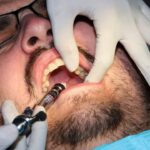 Broken Tooth Emergency Dentist in Avondale