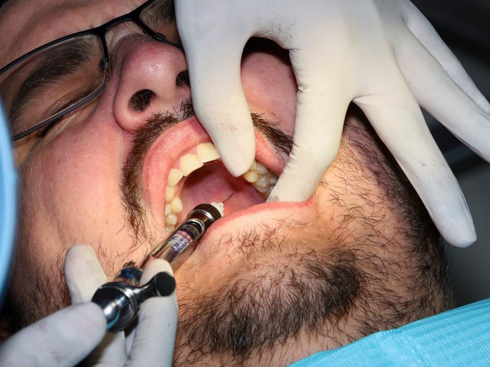 Broken Tooth Emergency Dentist in Avondale