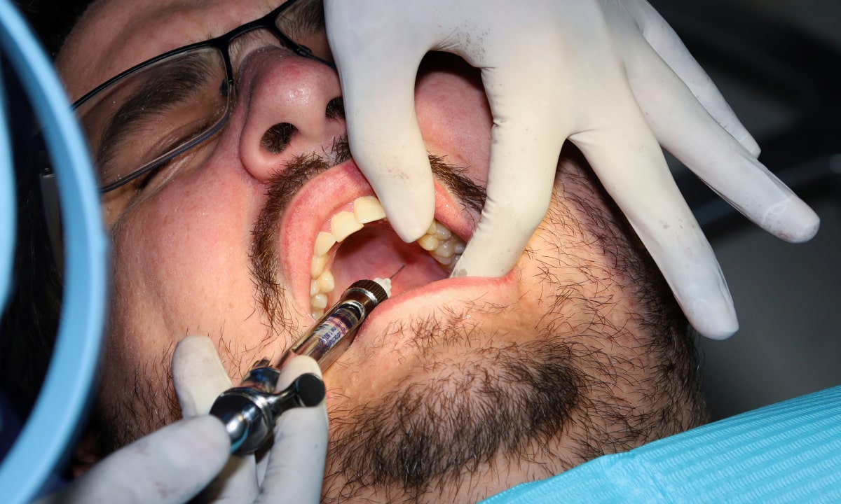 Broken Tooth Emergency Dentist in Avondale