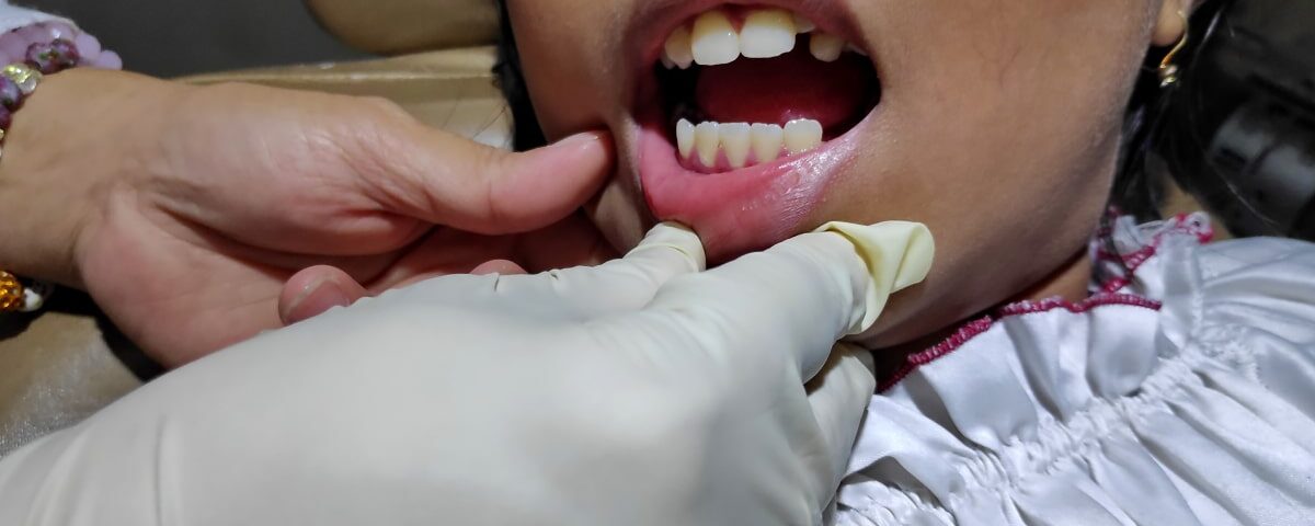 How Much Do Dental Abscess Treatments Cost in Avondale, AZ?