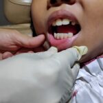 How Much Do Dental Abscess Treatments Cost in Avondale, AZ?