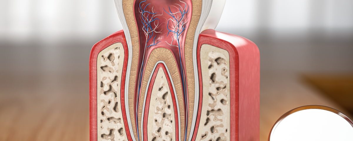 How to Know If You Need a Root Canal Treatment?