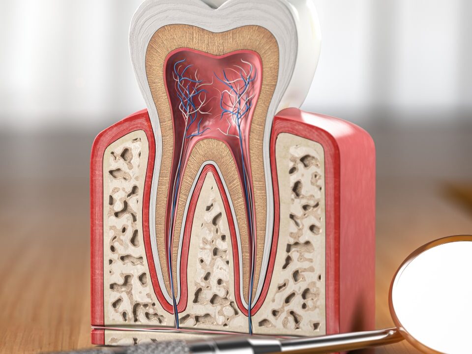 How to Know If You Need a Root Canal Treatment?